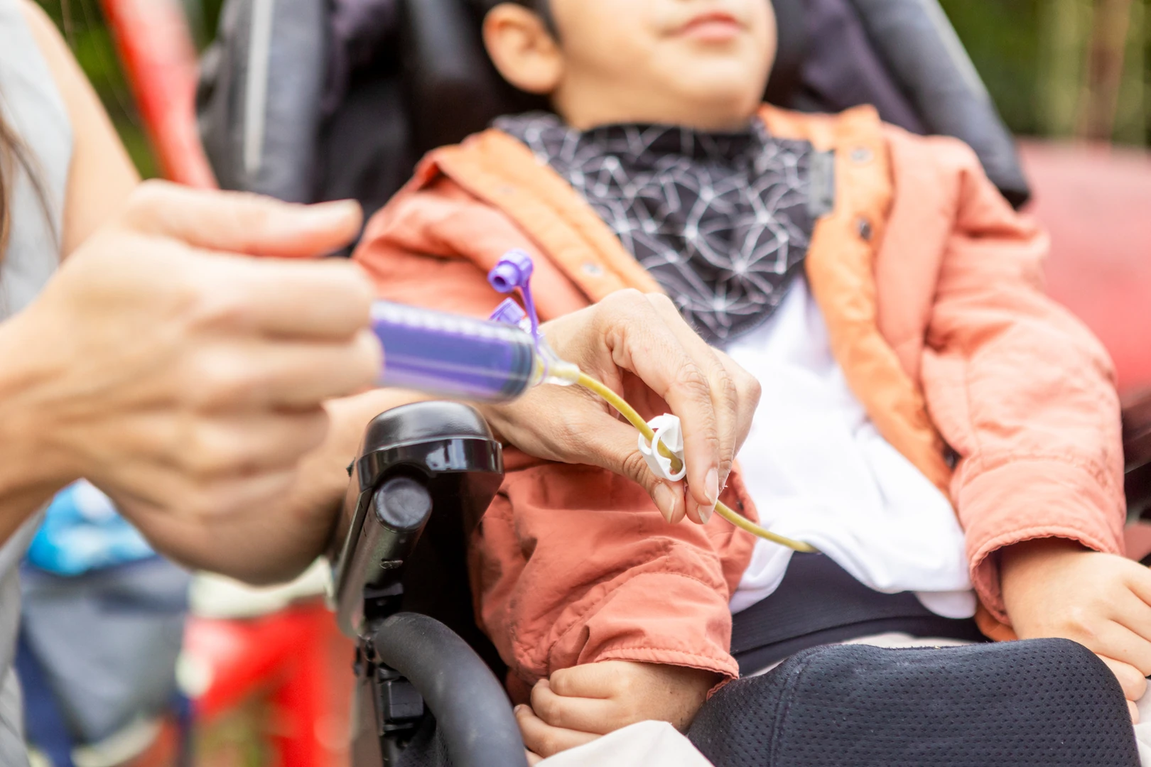 Nurse administering a G-tube feeding to a child